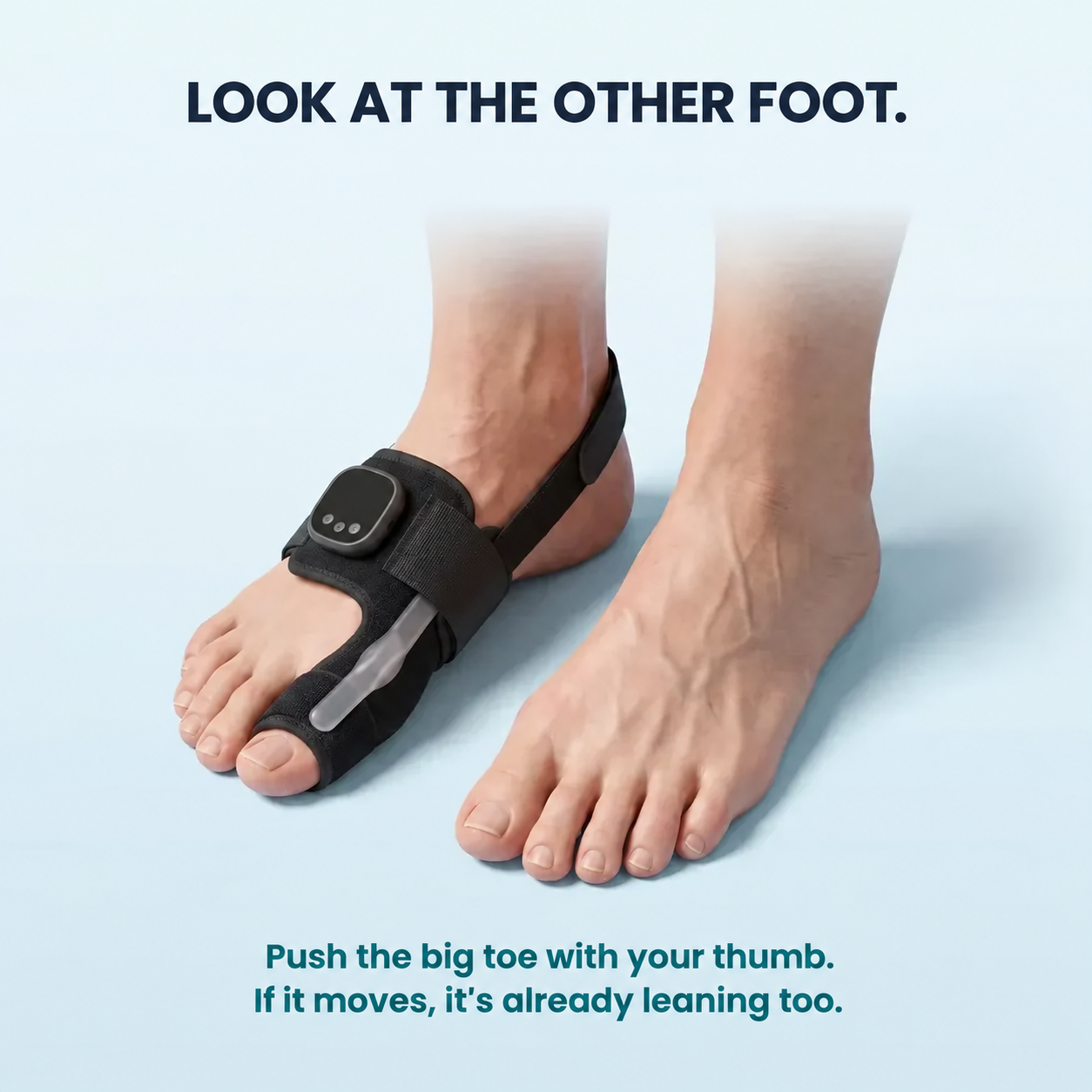 It holds your toe. And it retrains the muscle that's supposed to hold it.